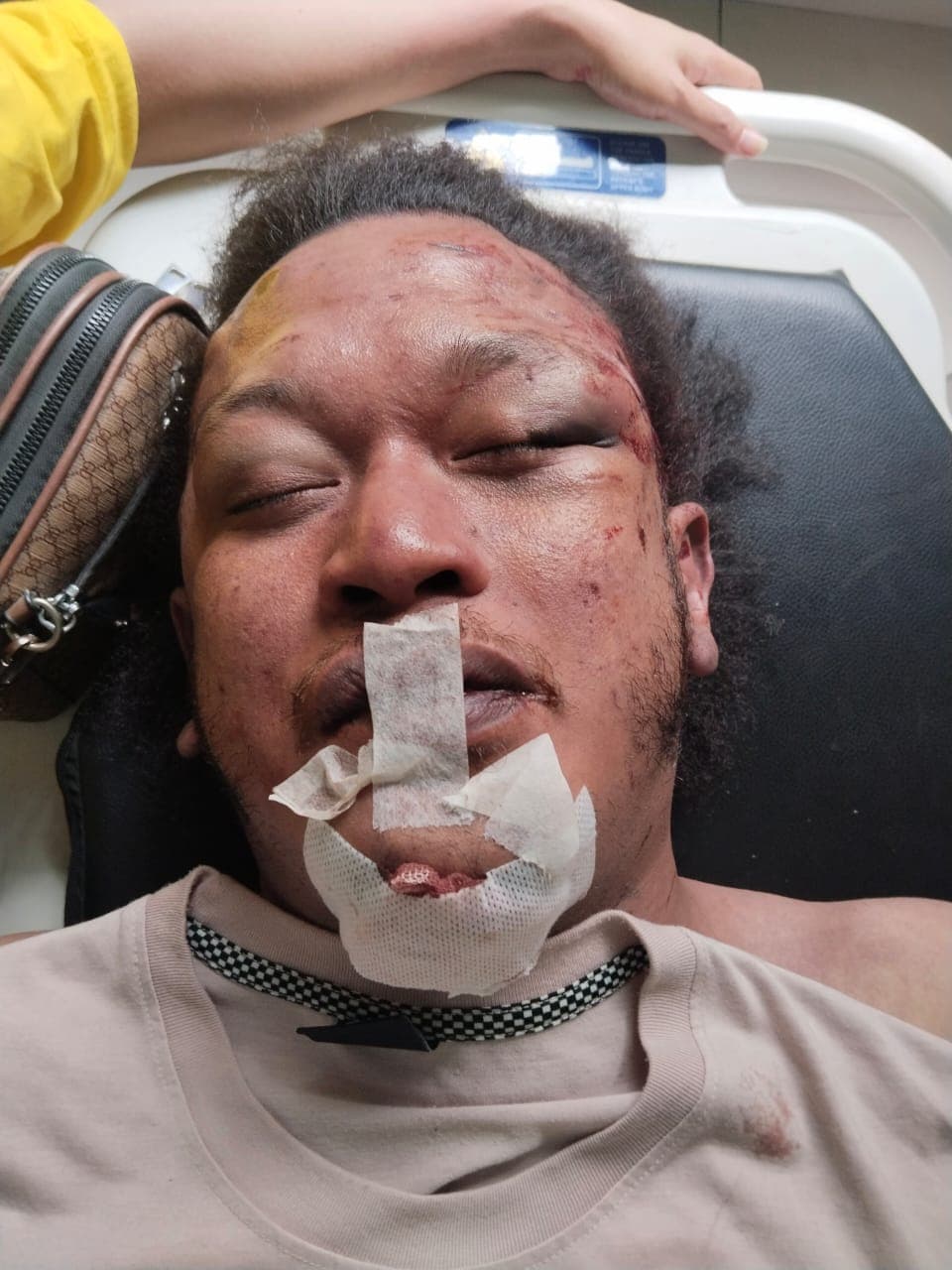 Jasad Penuh Luka, Keluarga Minta Polisi Usut Penyebab Kematian Nico Saragih